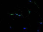 Cathepsin L Recombinant Mouse Monoclonal Antibody (12H6)