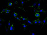 uPAR Recombinant Mouse Monoclonal Antibody (2E2)