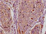 Flotillin 1 Antibody in Immunohistochemistry (Paraffin) (IHC (P))