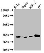 CCP2 Monoclonal Antibody (1F3C12)