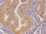 PRDX3 Antibody in Immunohistochemistry (Paraffin) (IHC (P))