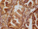 PRDX3 Antibody in Immunohistochemistry (Paraffin) (IHC (P))