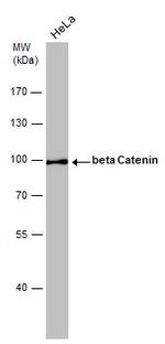 beta Catenin Antibody in Western Blot (WB)