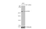 TET1 Antibody in Western Blot (WB)