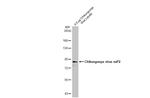 Chikungunya Virus NSP2 Antibody in Western Blot (WB)