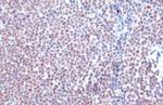 HDAC2 Recombinant Rabbit Monoclonal Antibody (HL1545)