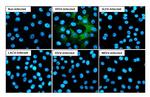 Venezuelan Equine Encephalitis Virus NSP4 Recombinant Rabbit Monoclonal Antibody (HL1741)