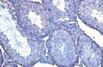 HSC70 Recombinant Rabbit Monoclonal Antibody (HL1788)