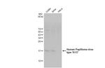HPV Type 16 E7 Recombinant Rabbit Monoclonal Antibody (HL1821)