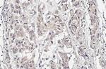MAP2K4 Recombinant Rabbit Monoclonal Antibody (HL1839)