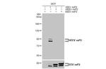 Venezuelan Equine Encephalitis Virus NSP2 Antibody in Western Blot (WB)