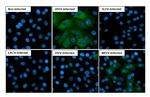 Equine Encephalitis Virus NSP2 Antibody in Immunocytochemistry (ICC/IF)