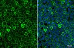 FCGR2B Recombinant Rabbit Monoclonal Antibody (HL1950)