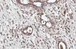 IGF1R (CD221) Antibody in Immunohistochemistry (Paraffin) (IHC (P))
