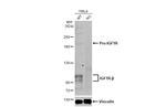 IGF1R (CD221) Antibody in Western Blot (WB)