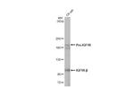 IGF1R (CD221) Antibody in Western Blot (WB)