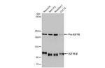 IGF1R (CD221) Antibody in Western Blot (WB)
