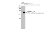 PRRS Virus Nucleocapsid Protein Antibody in Western Blot (WB)