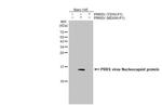 PRRS Virus Nucleocapsid Protein Antibody in Western Blot (WB)