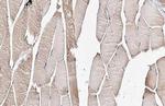 PDLIM3 Antibody in Immunohistochemistry (Paraffin) (IHC (P))