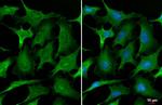 Annexin A1 Recombinant Rabbit Monoclonal Antibody (HL2142)
