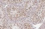 POLE Antibody in Immunohistochemistry (Paraffin) (IHC (P))
