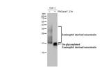 RNASE2 Antibody in Western Blot (WB)