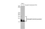 RNASE2 Antibody in Western Blot (WB)