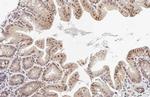 HAX1 Recombinant Rabbit Monoclonal Antibody (HL2170)
