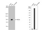 BCL6 Recombinant Rabbit Monoclonal Antibody (HL2192)