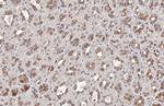 FN3K Recombinant Rabbit Monoclonal Antibody (HL2223)