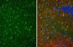 S100B Recombinant Rabbit Monoclonal Antibody (HL2228)