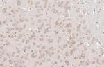 YTHDF3 Antibody in Immunohistochemistry (Paraffin) (IHC (P))