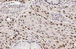p53 Recombinant Rabbit Monoclonal Antibody (HL2242)