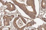 RPLP2 Antibody in Immunohistochemistry (Paraffin) (IHC (P))