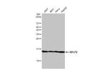 RPLP2 Antibody in Western Blot (WB)