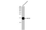 RPLP2 Antibody in Western Blot (WB)