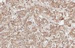 CHOP Antibody in Immunohistochemistry (Paraffin) (IHC (P))