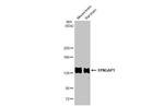 SynGAP Antibody in Western Blot (WB)