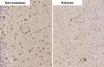 RNF31 Antibody in Immunohistochemistry (Paraffin) (IHC (P))