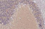 VPS34 Antibody in Immunohistochemistry (Paraffin) (IHC (P))