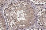 CP110 Recombinant Rabbit Monoclonal Antibody (HL2312)