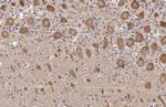 TLR3 Antibody in Immunohistochemistry (Paraffin) (IHC (P))