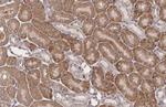 RNaseL Antibody in Immunohistochemistry (Paraffin) (IHC (P))