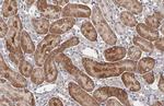 RNaseL Antibody in Immunohistochemistry (Paraffin) (IHC (P))