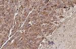 PELO Antibody in Immunohistochemistry (Paraffin) (IHC (P))