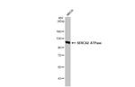 SERCA2 ATPase Antibody in Western Blot (WB)