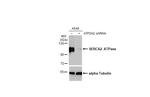 SERCA2 ATPase Antibody in Western Blot (WB)
