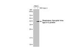 RSV Type A Glycoprotein G Recombinant Rabbit Monoclonal Antibody (HL2354)