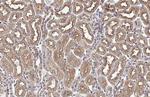 SNX5 Antibody in Immunohistochemistry (Paraffin) (IHC (P))